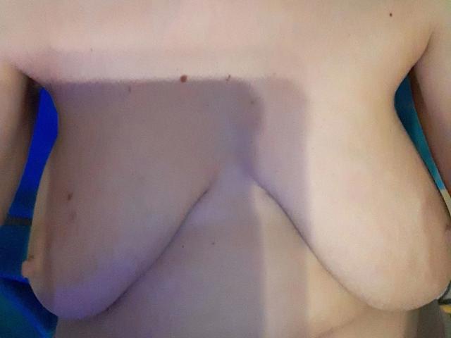 Sexybienchen93-hot's bare chest with large, saggy tits, pale skin, and a shadow across the upper part. Small red marks are visible on the upper chest.