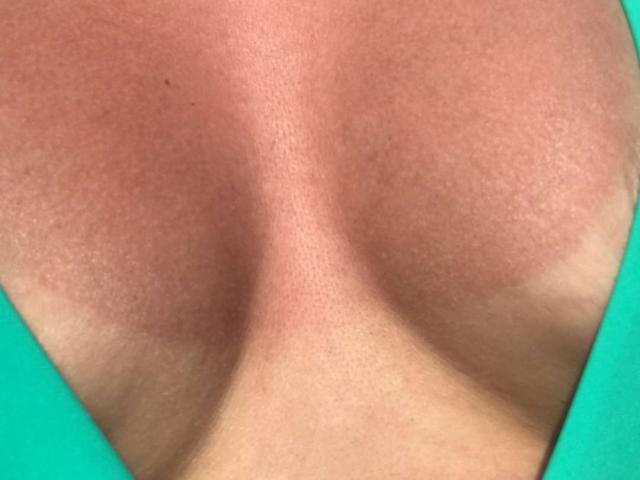 Misstyk's tan, rounded, upper-boob area with visible tan lines and slight skin texture, wearing a green top that's partially visible on the sides.