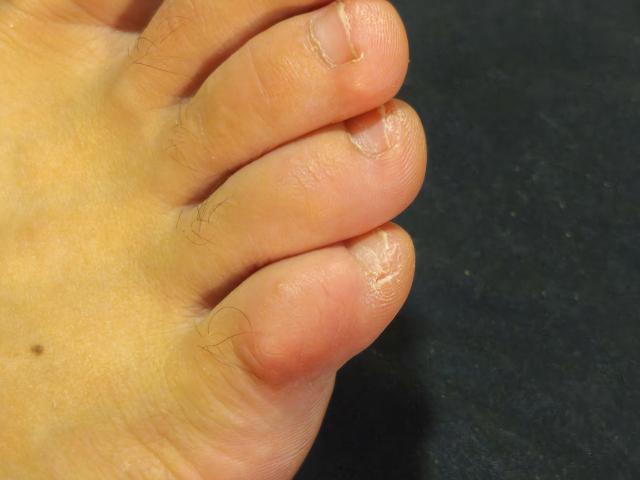 OrianaLaFrancaise's toe is a small, slightly dirty, pinkish-brown, wrinkly booger with a tiny mole and some barely visible hair on the skin.