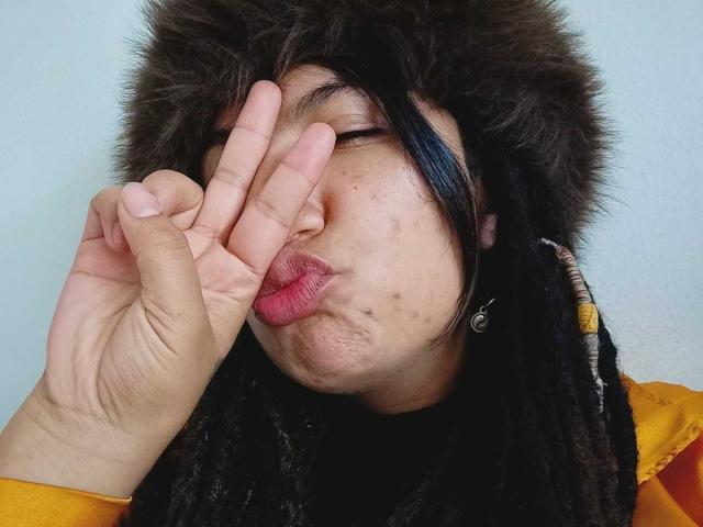 BeckyHuston with black dreads, puffy fur hat, and yellow jacket, pouting with her hand covering her eye, showing her pink lips and a few acne spots on her face.