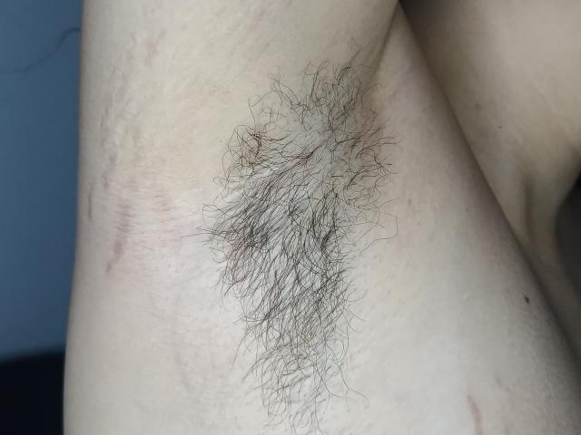 AlanisSweet's armpit with a dense, dark, curly patch of hairy growth on pale skin. Visible skin texture and slight redness around the hairy area.