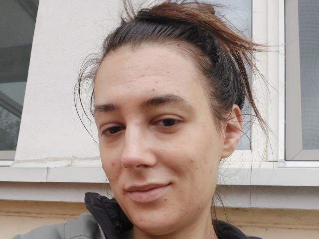Close-up of JuliaHuntis' face. She has light skin with visible acne and small pimples, especially on her nose and cheek. Her dark brown hair is messy and pulled back into a ponytail. She wears a grey jacket with a black collar. Her eyebrows are thin and slightly raised. She has a small, subtle smile. The background shows a white window with a partially visible glass pane. The image has a casual, unpolished feel.