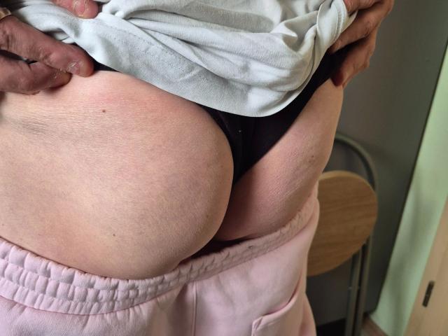 Close-up of Rocketman-hot's lower back and buttocks. Rocketman-hot's hands are lifting a white shirt, revealing black underwear that slightly exposes their pale, slightly reddened buttocks. Pink pants are pulled down to mid-thigh. Textured skin with visible pores and small bruises. A wooden chair is partially visible in the background. The image focuses on the contrast between the white shirt, black underwear, and pink pants. Natural lighting highlights the textures and colors.