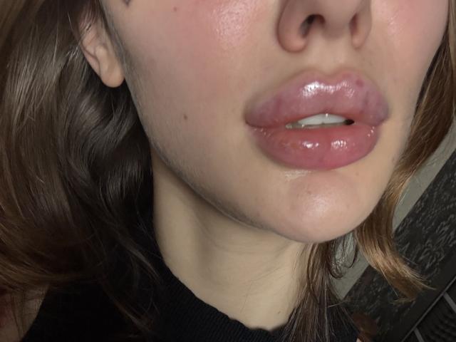 SensualMila's glossy pink lips are slightly parted, showing a hint of her teeth. Her shiny, fair skin has a few small moles. Brown hair is partially visible.