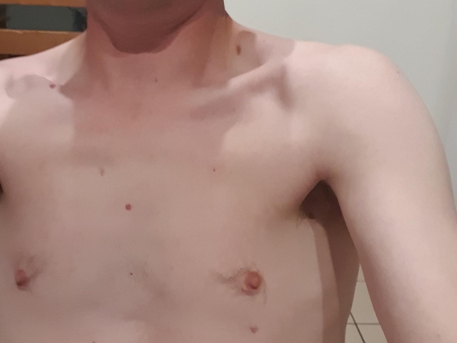 JejeoS's bare, pale chest with small, pink nipples and a few moles. JejeoS's collarbones are visible, with a slight shadow under the chin.