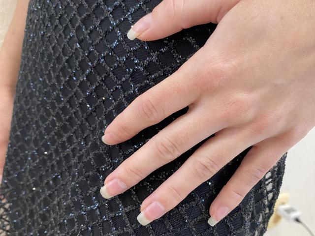 Amberia's hand with French-tipped nails rests on her black, diamond-patterned dress. Her fingers are slightly curled, showing off her fair skin and delicate fingers.