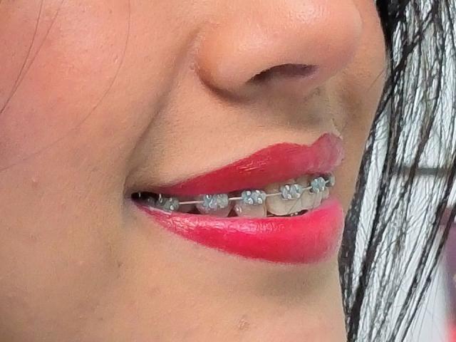 EstrellaXHot's face showing her shiny pink lipstick and metal-braced teeth, with a slight smile, her nose in the upper left, and wet black hair on the right.