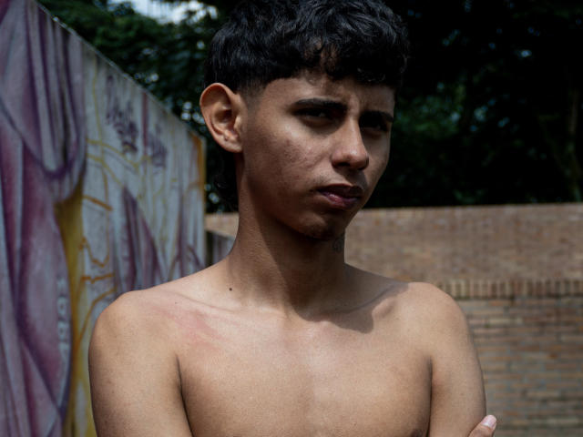 Shirtless JacobVillalobos with dark curly hair, slight tan, and a small tattoo near his neck, looking annoyed, arms crossed, red marks on chest, standing outdoors.