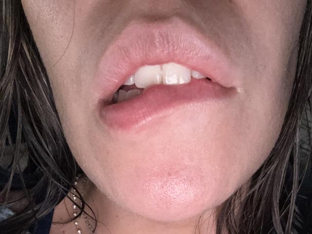 Close-up of SeleneBrigth's face showing her slightly parted pinkish lips with white, slightly uneven teeth. Her brown, wet hair is visible on the sides. Her skin is smooth with a light tan. She has a subtle sheen on her lower lip. A thin necklace is visible near her chin. The image focuses on her lips and teeth, with minimal background. The texture of her lips is slightly glossy. The photo is tight, filling the frame with her face.