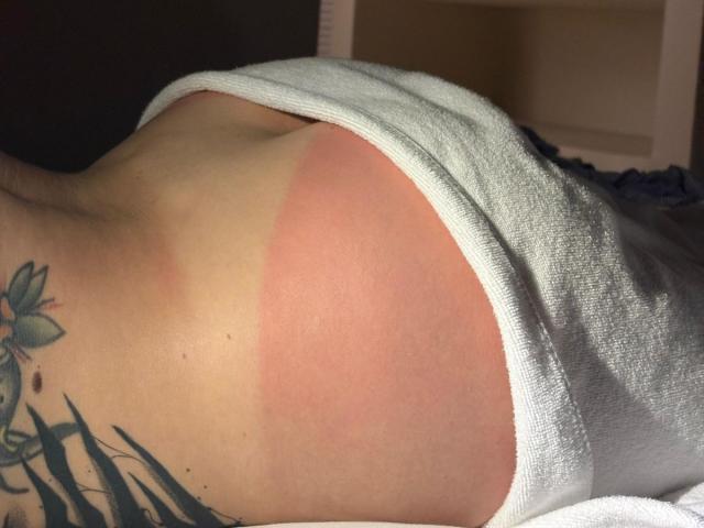 MalenaJones' bare ass, showing a prominent tan line, with white underwear pulled down, exposing a red-brown sunburned patch. Tattoo visible on her right side.