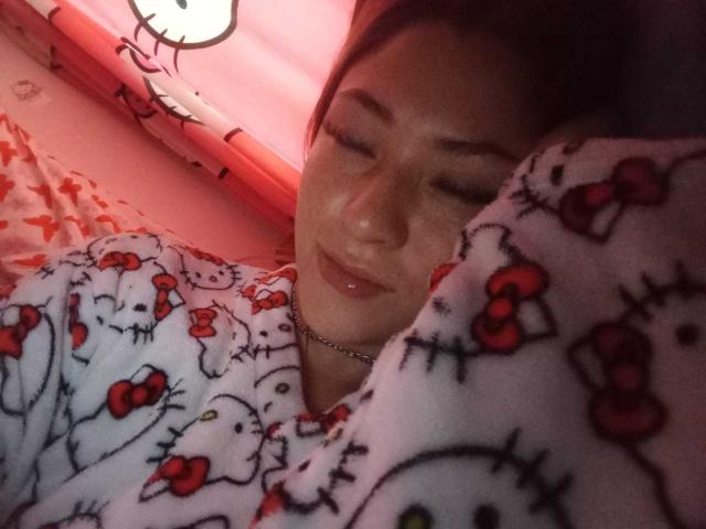 SamanthaCollen is sleeping with her eyes closed, wearing a Hello Kitty pajama set with red bows, looking slightly puffy and with a small nose bump.