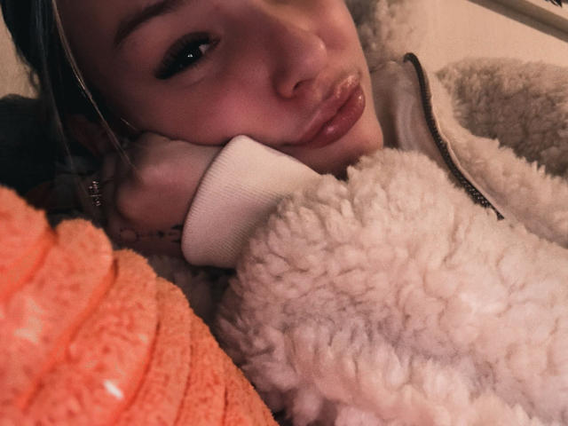 AngelaLuxe's pouty face rests on a fluffy white jacket, her glossy pink lips slightly parted. She's wearing an orange textured sweater, her dark hair partially visible.