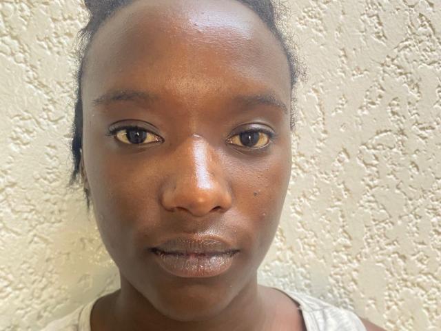 BlackFirre has dark brown skin, small brown eyes, and slightly parted lips with a small beauty mark on the right side of her nose. She's wearing a white top.