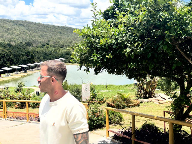 LucasJandre-hot stands in the foreground, facing left. He has short, gray-brown hair and wears a white t-shirt with a small logo on the left chest. He has tattoos on his right arm and wears sunglasses. His skin is light with a red rash on his right cheek. Behind him is a lush green landscape with a small lake, yellow railing, and dense trees. A bright, clear sky with scattered clouds is above. A large, green-leaved tree is to the right. The image is a photograph.