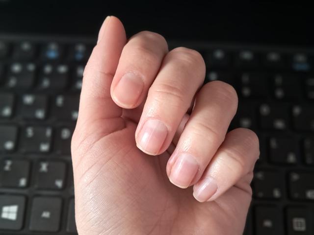 Amberia's hand with slightly dirty, short, pinky-nail-less fingers, showing a small cut on the index finger's tip, resting on a black keyboard.