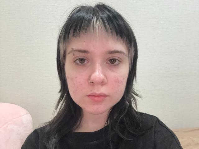 LennieCaronna has black and white hair, a nose ring, and a slightly red, pimpled face with a neutral expression. She's wearing a black shirt.