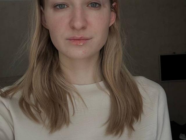 VenettaCorkill has light skin, blue eyes, and straight, medium-length blonde hair. She wears a beige, slightly wrinkled shirt. A small, clear blister is on her lower lip. The composition is centered, focusing on her face. The lighting is even, highlighting her natural skin texture. Her expression is neutral, with a slight, closed-lip smile. The background is blurred and dark.