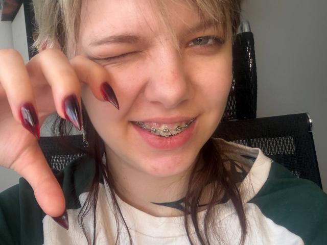 Close-up photo of LaurenceCloud with winking eye, showing metal braces and smiling. LaurenceCloud's hand with long, dark red nails frames face. Light brown hair, black and white shirt. Fucking hot.