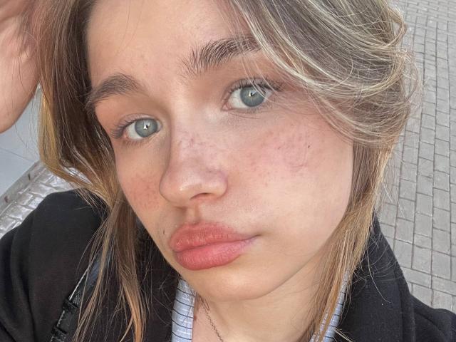 JennyOsmun's face with light brown hair, blue eyes, slightly flushed skin, freckles, and pink lips. She's wearing a black jacket over a white shirt.