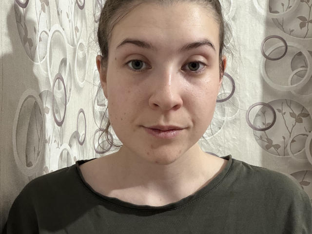 ZenaOutwater has a fair-skinned face with brown eyes, light brown hair in a bun, subtle acne, and a small pimple on her right cheek, wearing a dark green shirt.