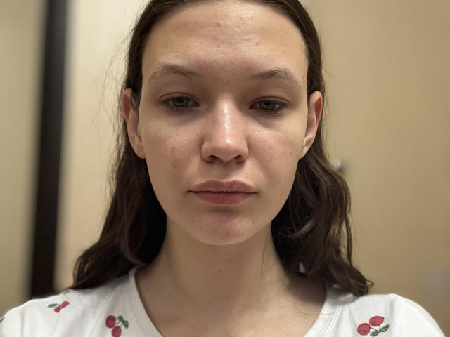 Close-up portrait of ReaColebrook, a young woman with light skin and brown hair. She has a neutral expression, slightly parted lips, and small, subtle nose. Her hair is loose, falling to the sides. She wears a white shirt with red cherry patterns. Her face is slightly shiny, with visible pores and light blemishes. The lighting is even, highlighting her facial features. The composition focuses on her face, with a soft, blurry background. The image is realistic and detailed.