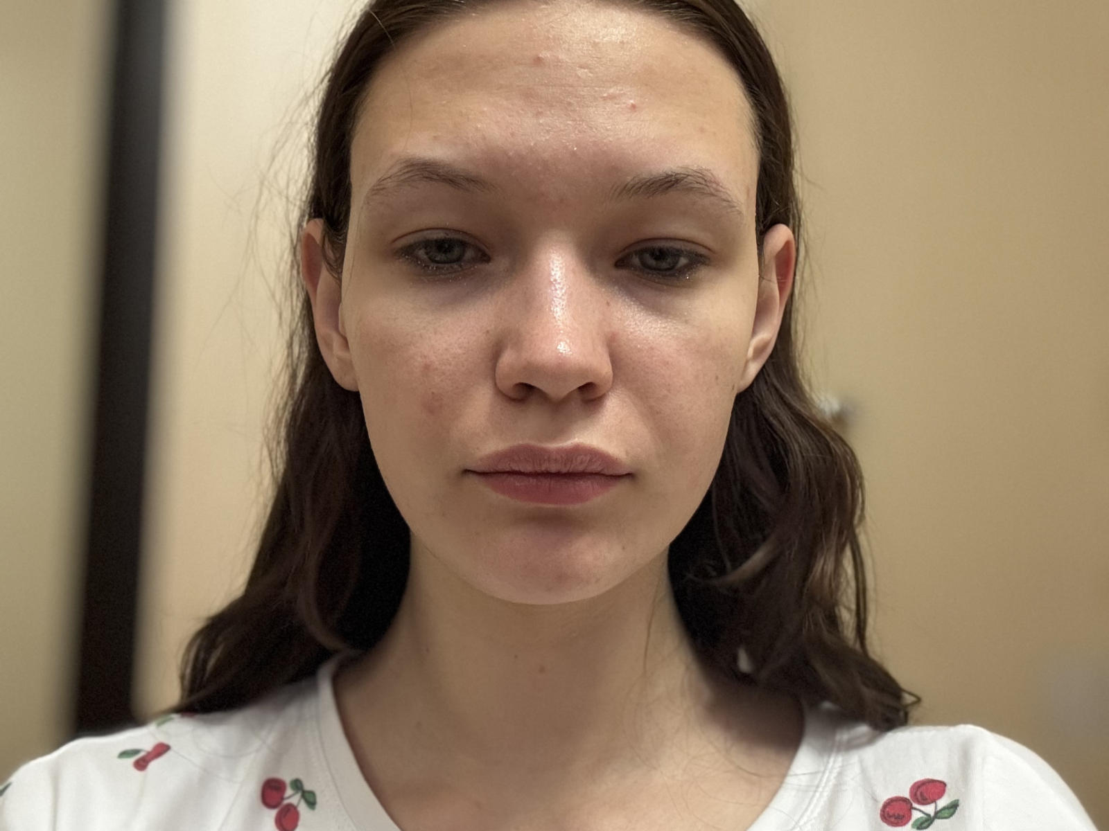 Close-up portrait of ReaColebrook, a young woman with light skin and brown hair. She has a neutral expression, slightly parted lips, and small, subtle nose. Her hair is loose, falling to the sides. She wears a white shirt with red cherry patterns. Her face is slightly shiny, with visible pores and light blemishes. The lighting is even, highlighting her facial features. The composition focuses on her face, with a soft, blurry background. The image is realistic and detailed.