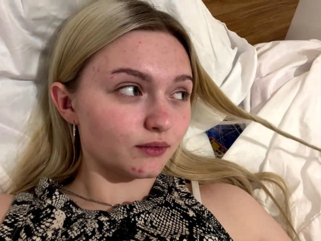 MaileStortz has blonde hair, light skin, and small zits on her nose. She's wearing a snake-pattern top, looking to the side with a neutral expression.