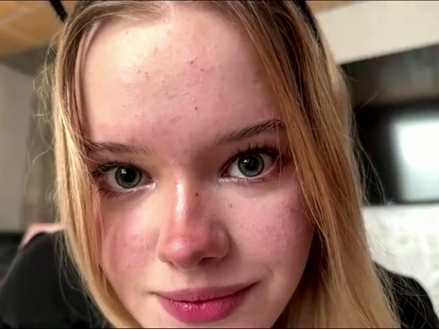 TerraHammar has freckled, slightly pink skin with blonde hair, blue eyes, and pink lipstick. Her face shows small pimples and she's smiling softly. Her boobs are not visible.