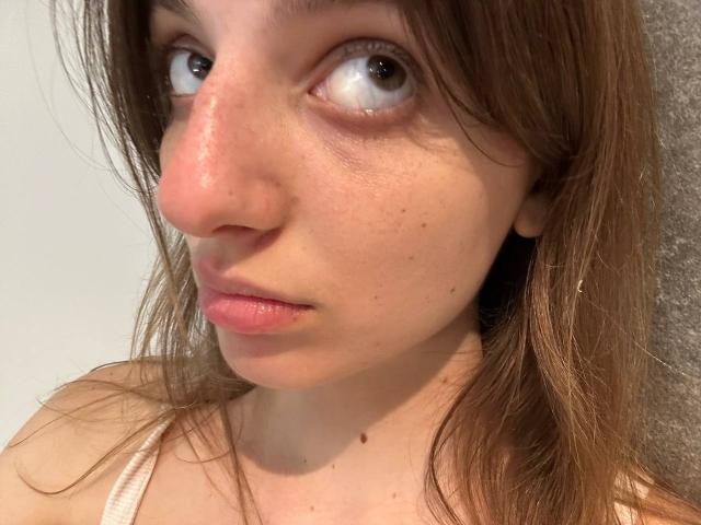 KarieMestler's face showing a red nose, slightly puffy eyes, and brown hair with a white tank top. She has small moles and a neutral expression.