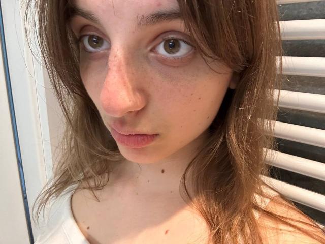 KarieMestler's face, brown eyes, slightly pink nose, freckles, and loose brown hair, wearing a white top, standing in front of white blinds.