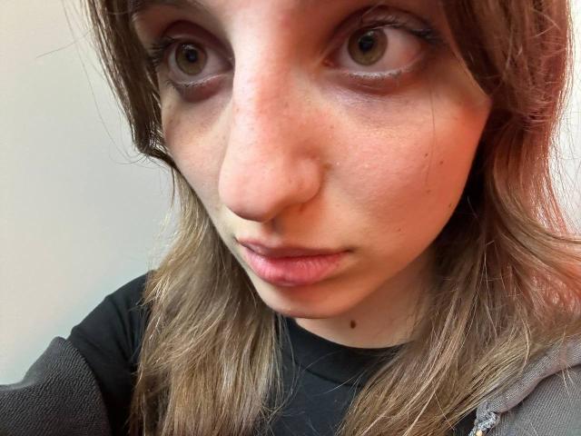 KarieMestler's face, with brown eyes, light brown wavy hair, and a slight pout, wearing a black shirt, showing a small mole under her chin.