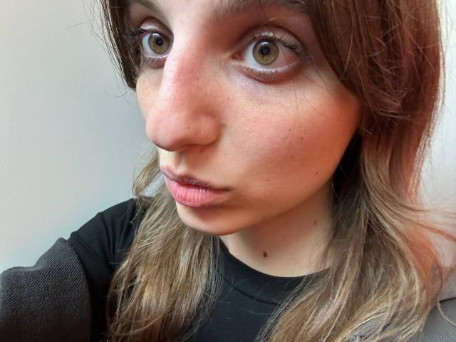 KarieMestler's face, showing brown eyes, pink lips, slight freckles, and brown hair, wearing a black shirt, with a small mole under her chin.