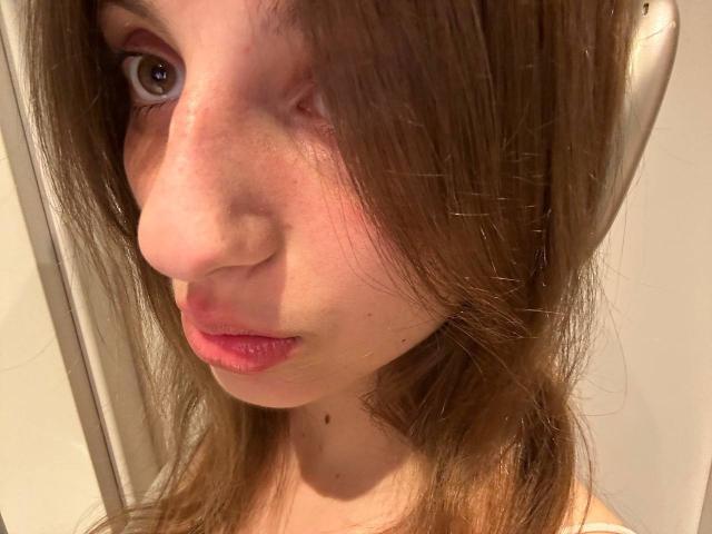 KarieMestler's face, showing a pimple on her nose, with brown hair partially covering her left eye, and pink lips, in a selfie, wearing a white top.