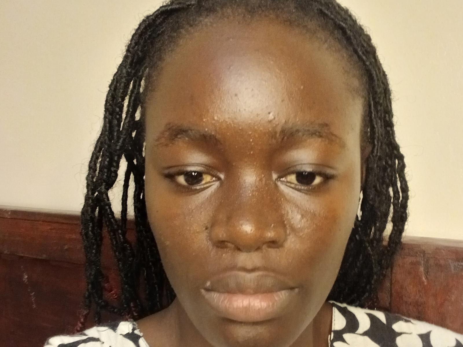 QuenOfTease has dark brown skin, small nose, and full lips. She has long black dreadlocks and is wearing a black and white patterned top. Her eyes are slightly downcast.