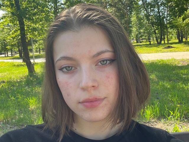 JennellMatacale has pale skin, green eyes, and brown shoulder-length hair, with small red blemishes on her face, wearing a black shirt, standing in a sunny, grassy park.