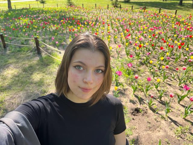 JennellMatacale with short brown hair, green eyes, black shirt, small pinkish bruise on cheek, standing in front of a colorful tulip field, taking a selfie.