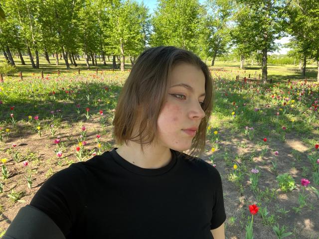 JennellMatacale, with short brown hair, wearing a black shirt, has red blemishes on her cheek, standing in a sunlit flower field, looking to the side.