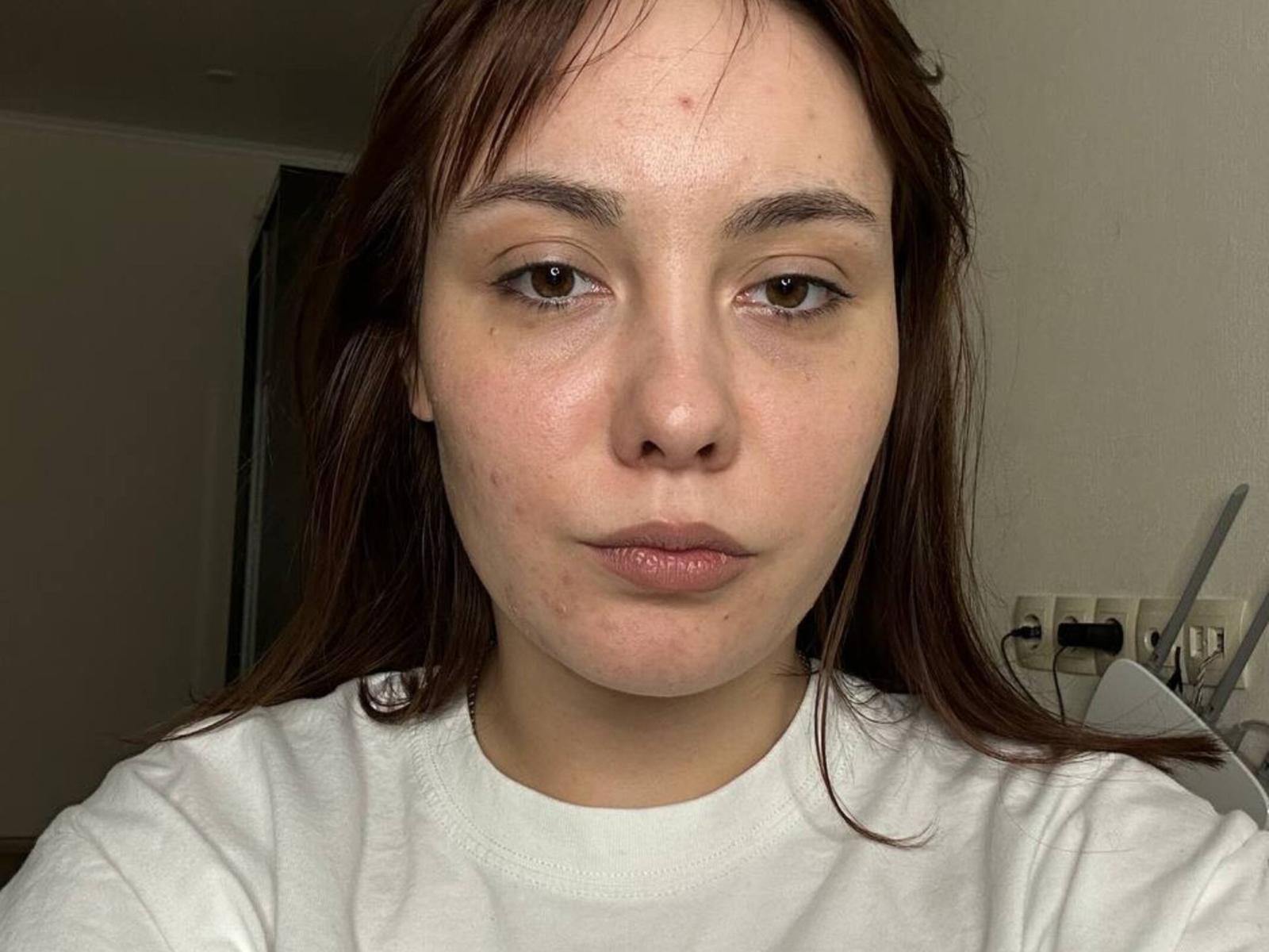 Edie Kumar a la peau claire, les yeux marron et les cheveux bruns. Elle porte une chemise blanche et a une expression neutre, une petite imperfection sur sa joue et des lèvres légèrement brillantes de couleur rose..