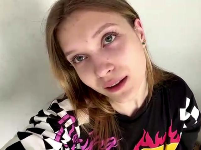 Vera Brabazon, met lichtbruin haar, groene ogen en een zwart/wit/roze shirt met een vlammotief, kijkt naar de camera met een lichte glimlach. Haar neus heeft een kleine rode vlek..