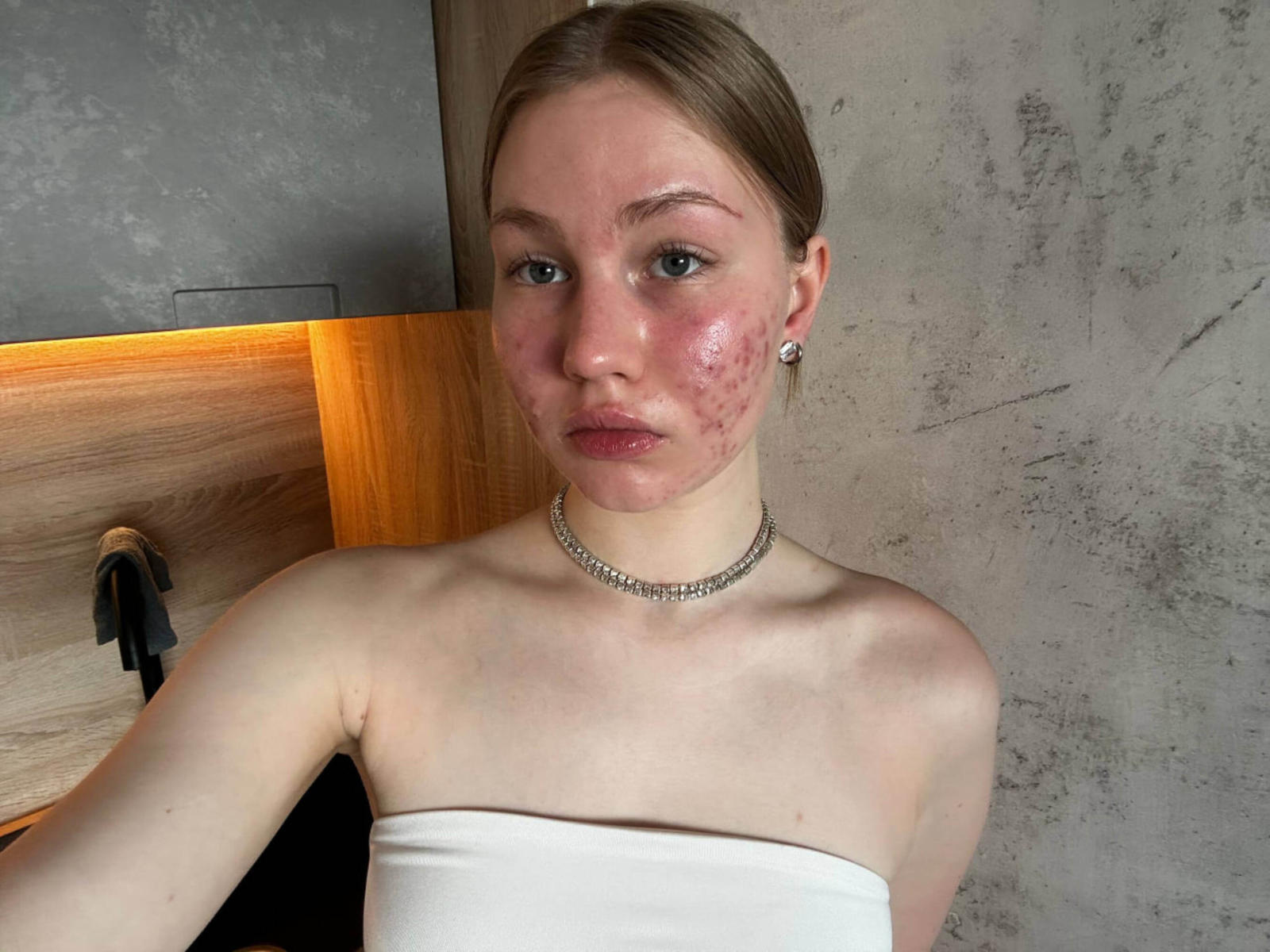 ZofiaZhu, con guance rosse e gonfie, indossa un top bianco senza spalline, una collana argentata e orecchini, in una stanza di legno e cemento, guardando direttamente la fotocamera..