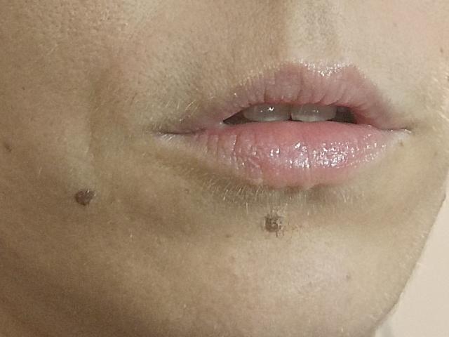 Le labbra rosa, leggermente lucide di OrianaLaFrancaise, sono al centro dell'immagine, con due piccole protuberanze cutanee marroni sulla guancia sinistra e sul labbro inferiore destro..