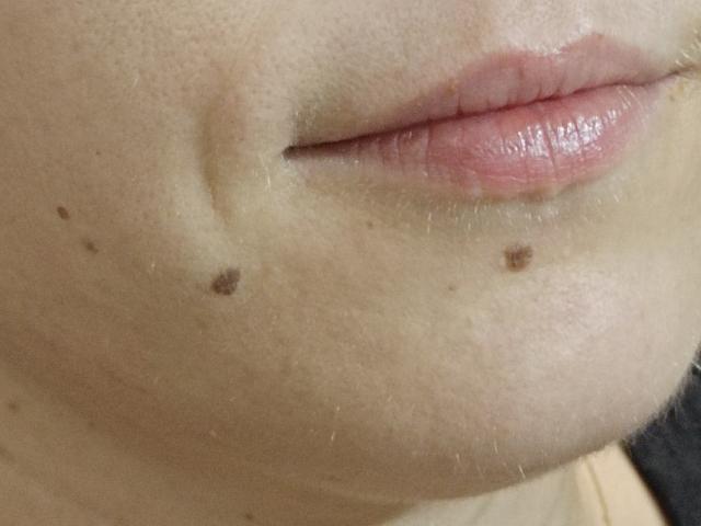 OrianaLaFrancaise's puffy pink lips with small brown moles on her slightly tan, textured skin. Her upper lip is slightly parted.