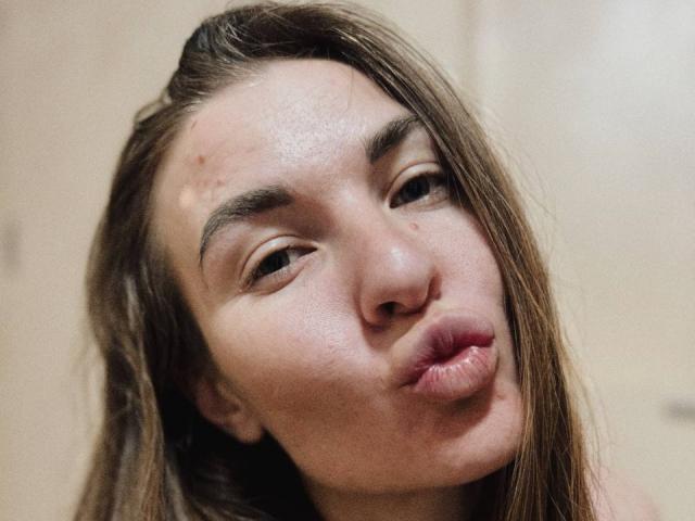 LumiEmma's face with pouty lips, brown eyes, and slightly messy long brown hair, showing small blemishes on her forehead. She's making a cute, puckered-up expression.