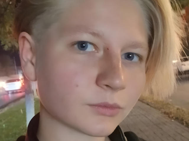 Das Gesicht von Laila Lafreniere mit heller Haut, blauen Augen, einem blonden Bob, einem kleinen Muttermal auf der rechten Wange, einem leichten rosafarbenen Schimmer und einem neutralen Ausdruck. Ihre Lippen sind leicht geöffnet..