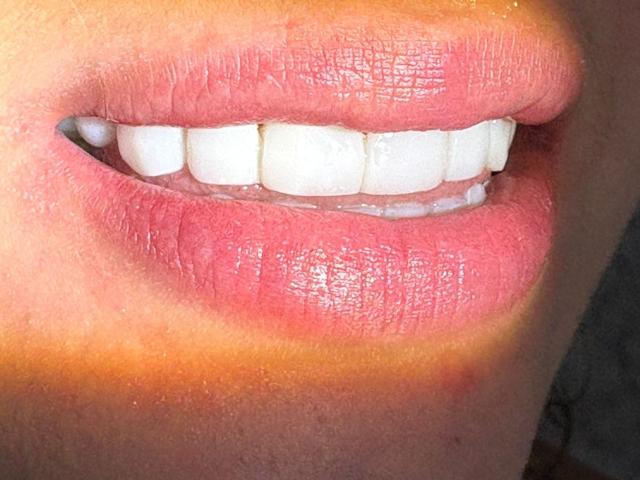 SashaPolet's pink, glossy lips are slightly parted, showing a set of straight, white, shiny teeth. The skin around the lips is a warm, light brown.