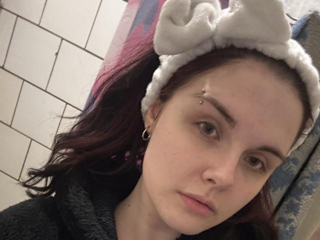 AnnaRenny, avec ses cheveux roux foncés, portant un bandeau blanc duveteux, a un petit piercing métallique au sourcil et un sweat à capuche noir et pelucheux. Son visage est légèrement gonflé, et elle regarde vers le bas..