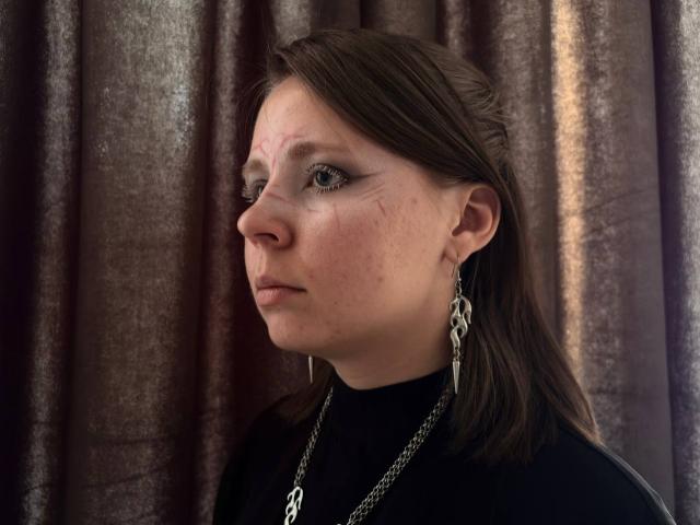 Johnetta Urtiaga, con moretones en la cara, vestida con un suéter negro de cuello alto, un collar de plata y aretes, tiene el cabello castaño y una expresión seria, frente a una cortina oscura..
