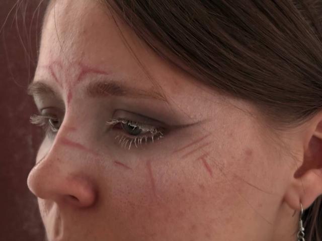 Il viso di Johnetta Urtiaga, con dei graffi rossi vicino all'occhio, i capelli castani e la pelle leggermente arrossata, mostra il suo profilo destro. Il suo occhio ha lunghe ciglia scure e indossa degli orecchini..
