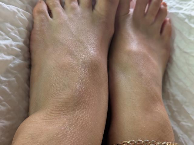 AuroraStar's feet are in the photo, showing her soles and toes with a slight tan and some visible skin texture. Her toes are slightly curled.