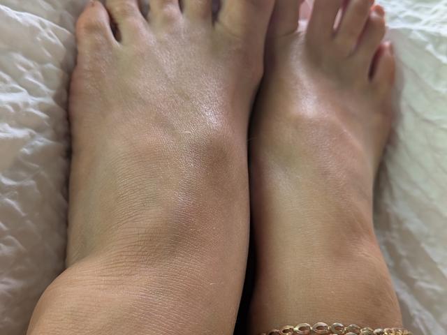 AuroraStar's feet are in the foreground, showing two bare soles with slightly rough skin and visible veins, positioned on a white, crinkled surface.